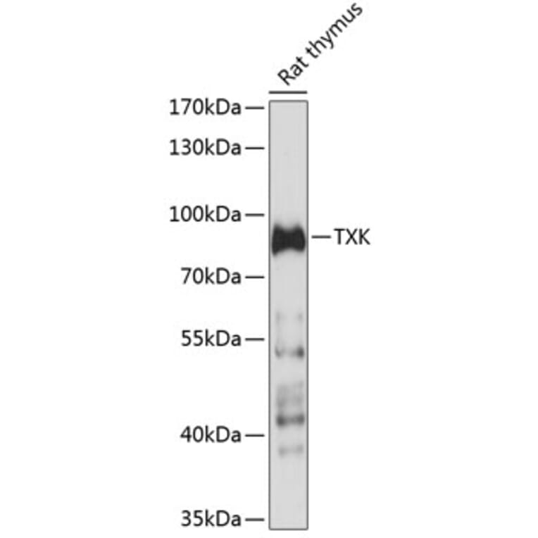 Western Blot - Anti-TXK/RLK Antibody (A91337) - Antibodies.com