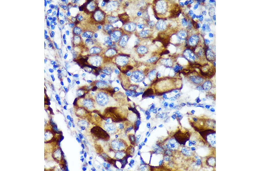 Immunohistochemistry - Anti-ABCF3 Antibody (A91338) - Antibodies.com