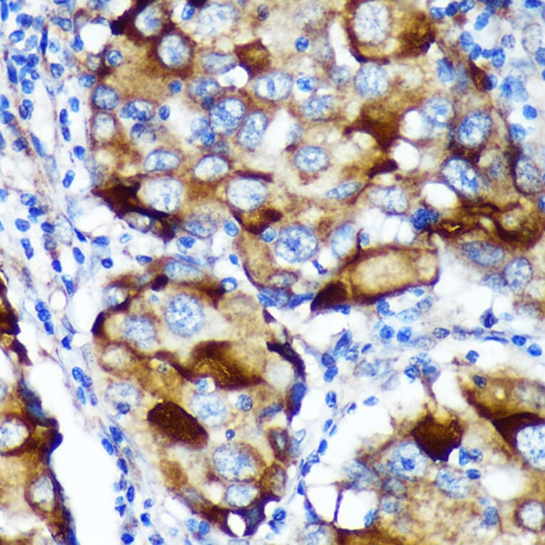 Immunohistochemistry - Anti-ABCF3 Antibody (A91338) - Antibodies.com