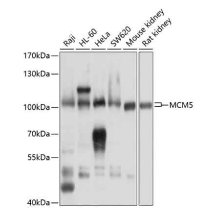 Western Blot - Anti-MCM5 Antibody (A91339) - Antibodies.com