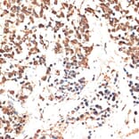 Immunohistochemistry - Anti-MCM5 Antibody (A91339) - Antibodies.com