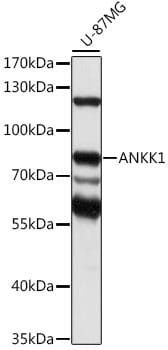 Western blot analysis of extracts of U-87MG cells, using Anti-ANKK1 Antibody (A16178) at 1:1,000 dilution.
Secondary antibody: Goat Anti-Rabbit IgG (H+L) (HRP) (AS014) at 1:10,000 dilution.
Lysates / proteins: 25µg per lane.
Blocking buffer: 3% non-fat dry milk in TBST.
Detection: ECL Basic Kit (RM00020).
Exposure time: 30s.