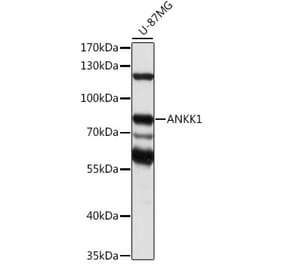 Western Blot - Anti-ANKK1 Antibody (A91340) - Antibodies.com
