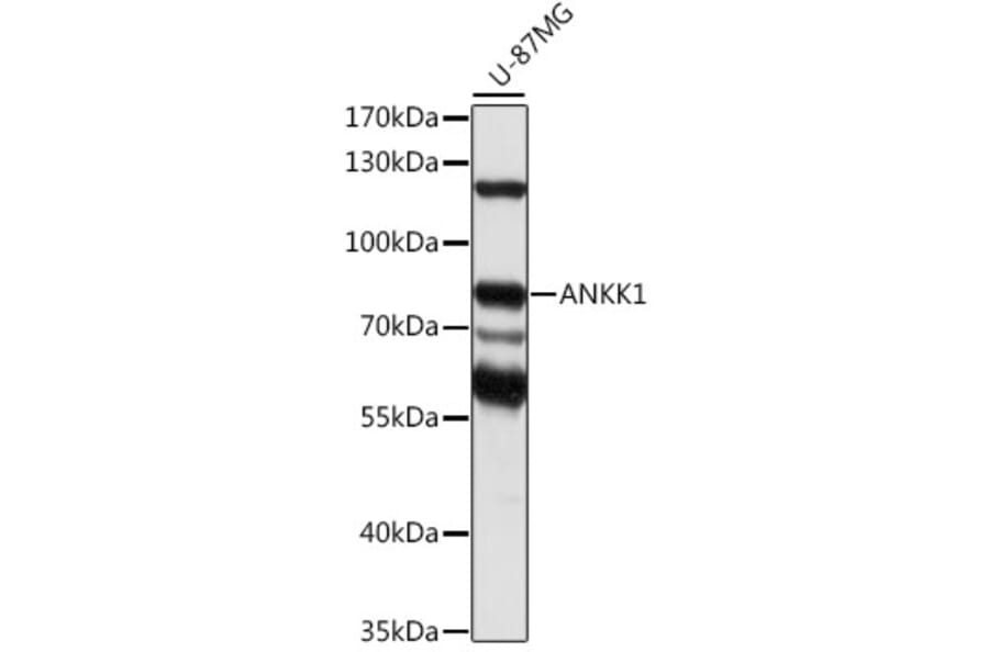 Western Blot - Anti-ANKK1 Antibody (A91340) - Antibodies.com