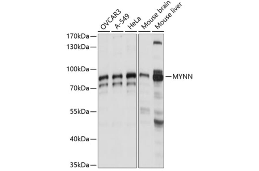 Western Blot - Anti-Myoneurin Antibody (A91341) - Antibodies.com