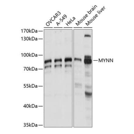 Western Blot - Anti-Myoneurin Antibody (A91341) - Antibodies.com