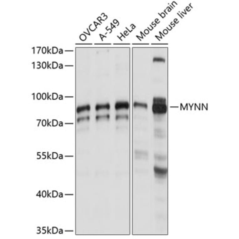 Western Blot - Anti-Myoneurin Antibody (A91341) - Antibodies.com