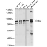 Western Blot - Anti-Myoneurin Antibody (A91341) - Antibodies.com