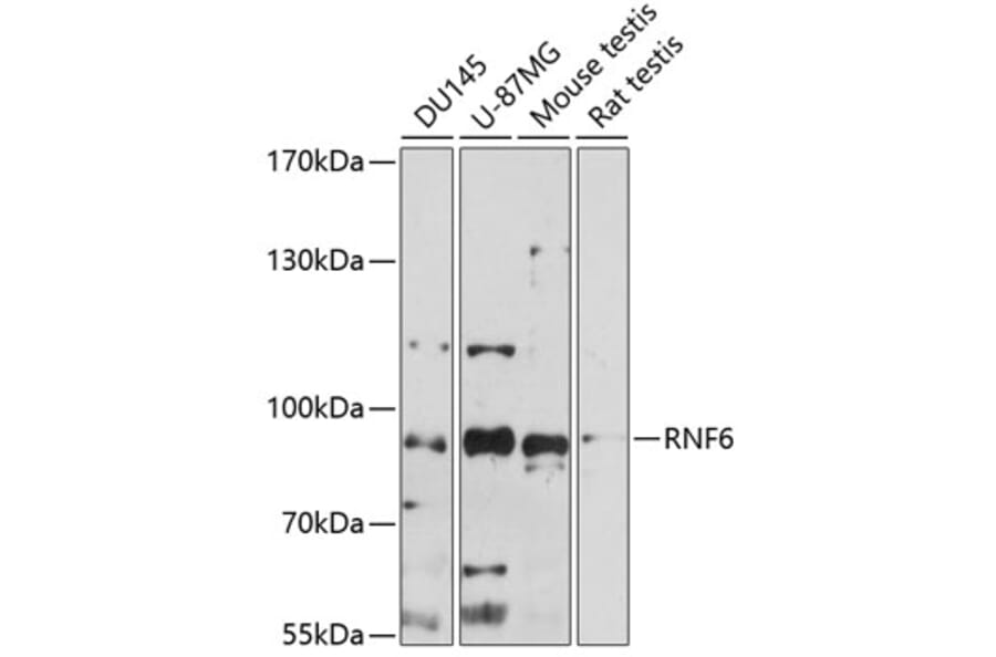 Western Blot - Anti-RNF6 Antibody (A91342) - Antibodies.com
