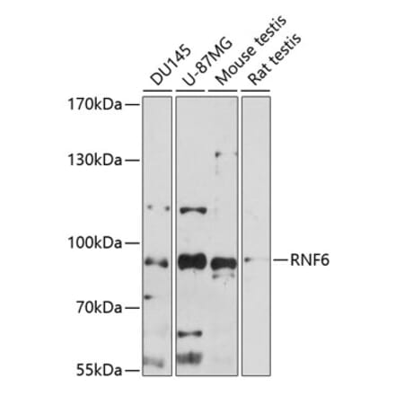 Western Blot - Anti-RNF6 Antibody (A91342) - Antibodies.com