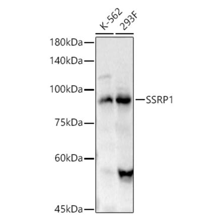 Western Blot - Anti-SSRP1 Antibody (A91343) - Antibodies.com