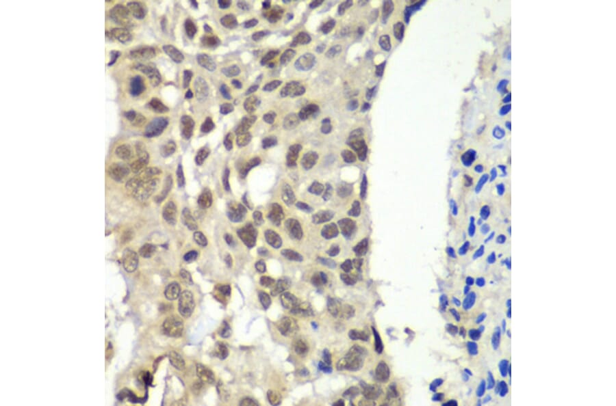 Immunohistochemistry - Anti-SSRP1 Antibody (A91343) - Antibodies.com