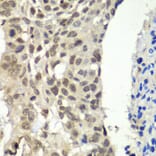 Immunohistochemistry - Anti-SSRP1 Antibody (A91343) - Antibodies.com