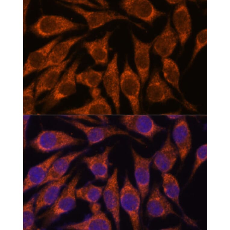Immunofluorescence - Anti-Semaphorin 3c Antibody (A91344) - Antibodies.com