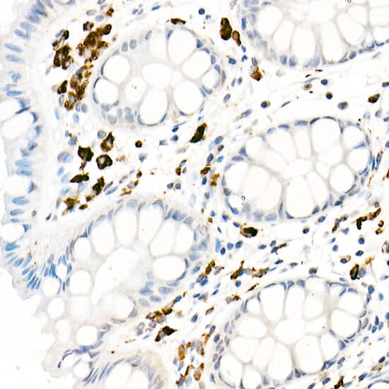 Anti-CD68 Antibody (A91346) | Antibodies.com