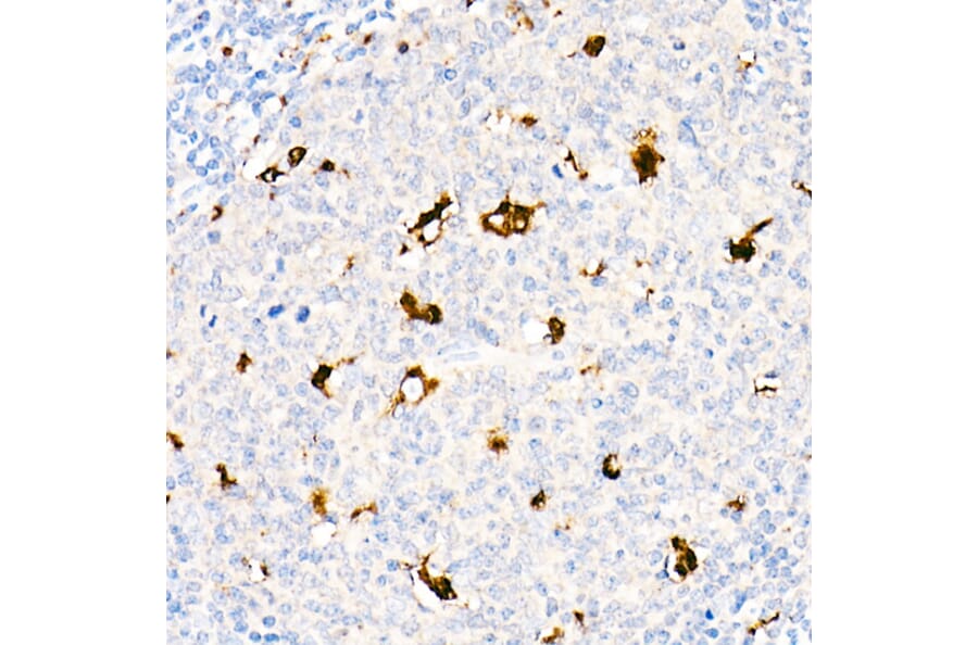 Immunohistochemistry - Anti-CD68 Antibody (A91346) - Antibodies.com