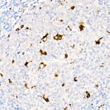 Immunohistochemistry - Anti-CD68 Antibody (A91346) - Antibodies.com