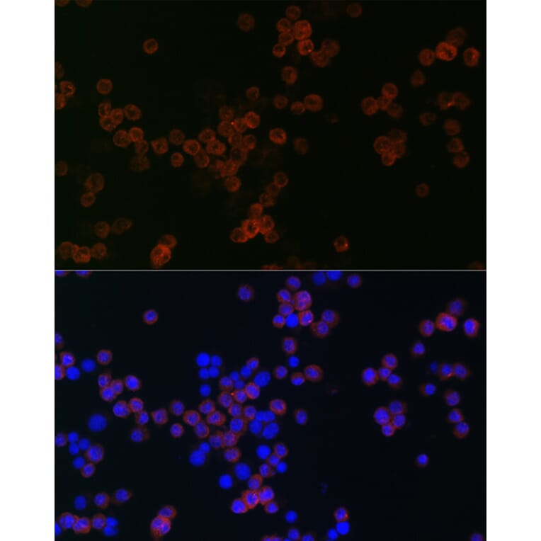 Immunofluorescence - Anti-CD68 Antibody (A91346) - Antibodies.com