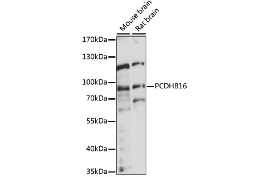 Western Blot - Anti-PCDHB16 Antibody (A91347) - Antibodies.com