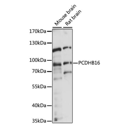 Western Blot - Anti-PCDHB16 Antibody (A91347) - Antibodies.com