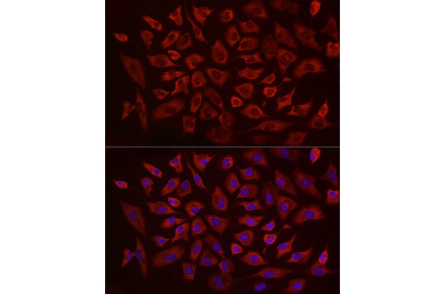 Immunofluorescence - Anti-eIF4B Antibody (A91348) - Antibodies.com