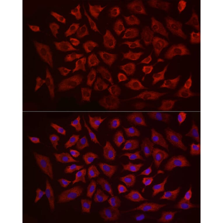 Immunofluorescence - Anti-eIF4B Antibody (A91348) - Antibodies.com