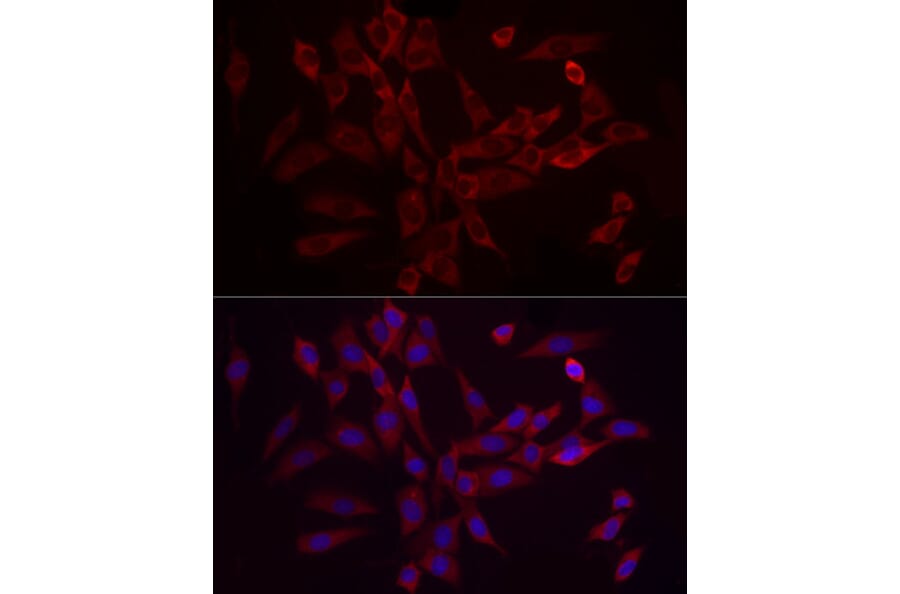 Immunofluorescence - Anti-eIF4B Antibody (A91348) - Antibodies.com