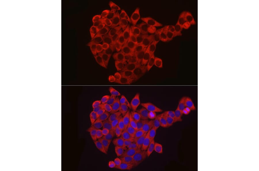 Immunofluorescence - Anti-eIF4B Antibody (A91348) - Antibodies.com