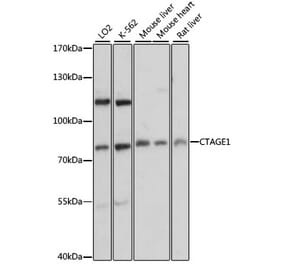 Western Blot - Anti-CTAGE1 Antibody (A91349) - Antibodies.com