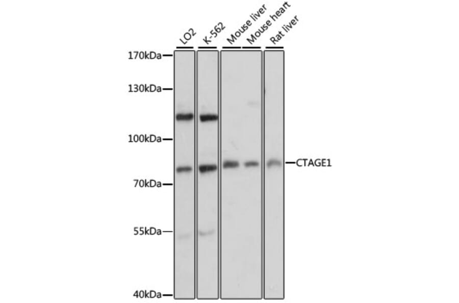 Western Blot - Anti-CTAGE1 Antibody (A91349) - Antibodies.com