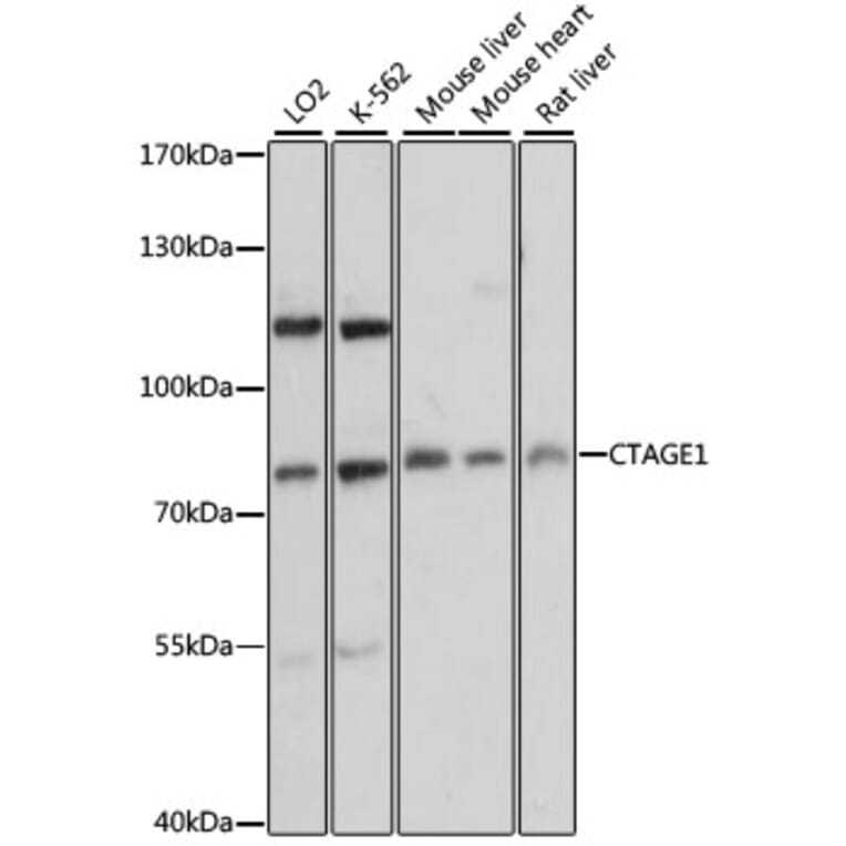 Western Blot - Anti-CTAGE1 Antibody (A91349) - Antibodies.com