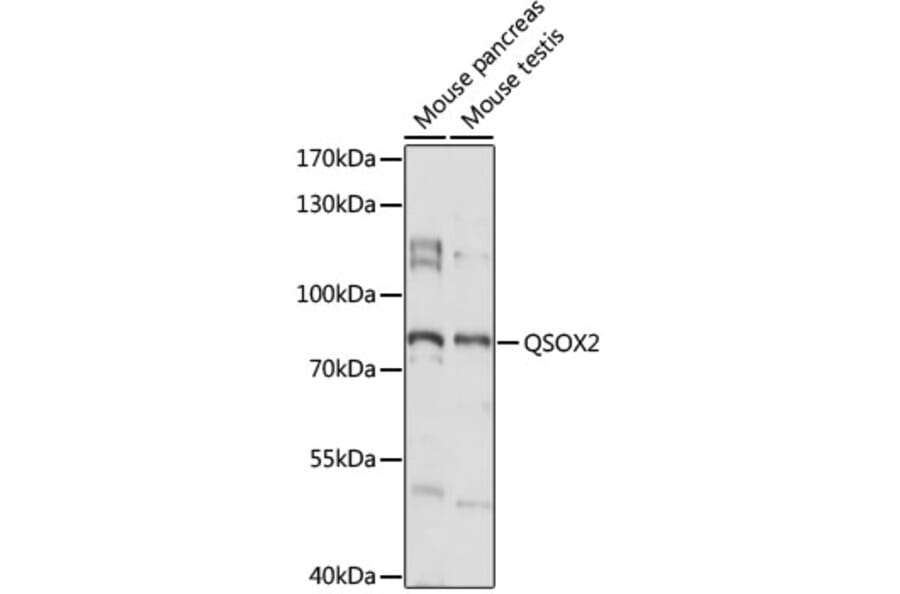 Western Blot - Anti-QSOX2 Antibody (A91350) - Antibodies.com