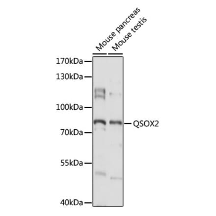 Western Blot - Anti-QSOX2 Antibody (A91350) - Antibodies.com