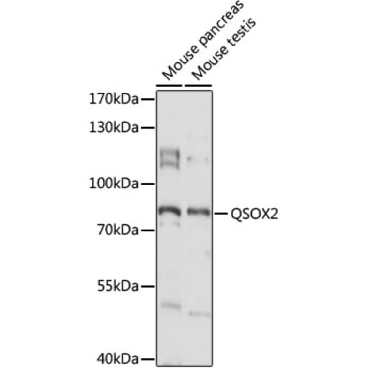Western Blot - Anti-QSOX2 Antibody (A91350) - Antibodies.com