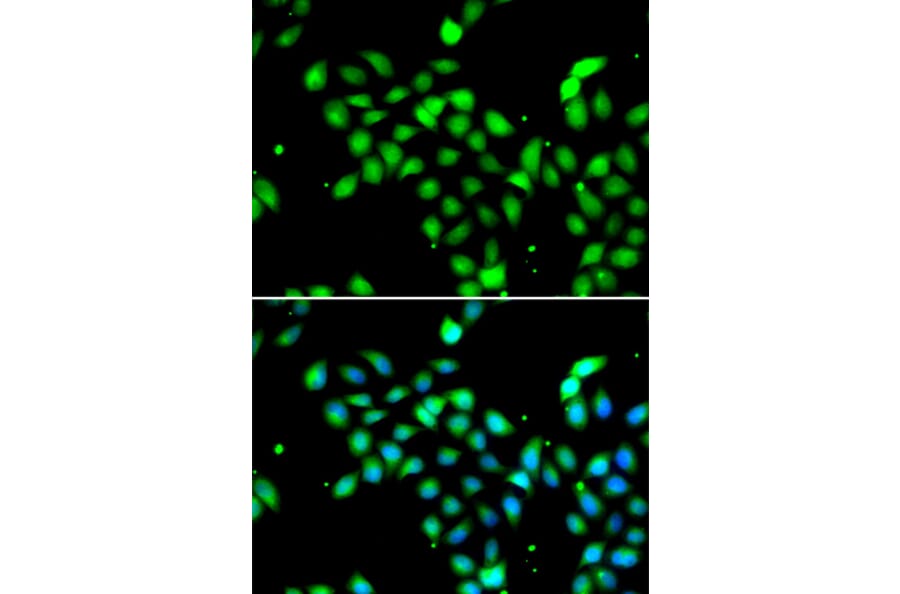 Immunofluorescence - Anti-METTL13 Antibody (A91351) - Antibodies.com