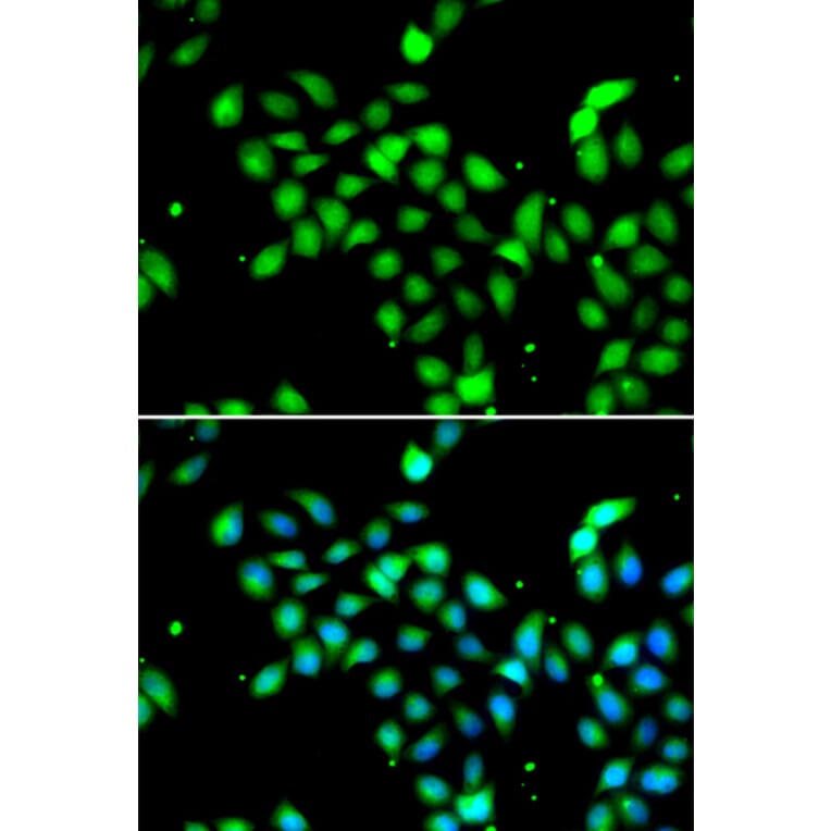 Immunofluorescence - Anti-METTL13 Antibody (A91351) - Antibodies.com