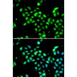 Immunofluorescence - Anti-METTL13 Antibody (A91351) - Antibodies.com