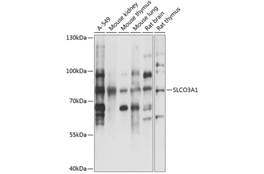 Western Blot - Anti-SLCO3A1 Antibody (A91352) - Antibodies.com