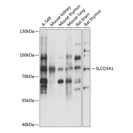 Western Blot - Anti-SLCO3A1 Antibody (A91352) - Antibodies.com