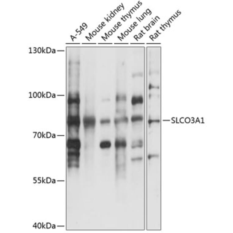 Western Blot - Anti-SLCO3A1 Antibody (A91352) - Antibodies.com