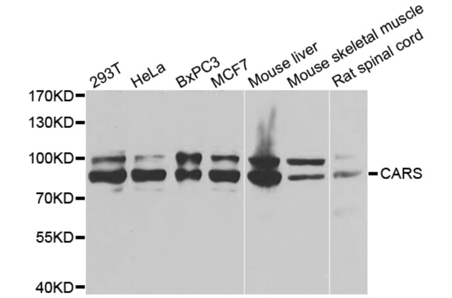 Western Blot - Anti-CARS Antibody (A13676) - Antibodies.com