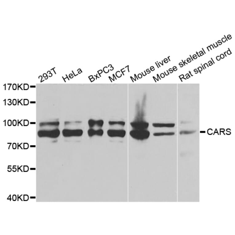 Western Blot - Anti-CARS Antibody (A13676) - Antibodies.com