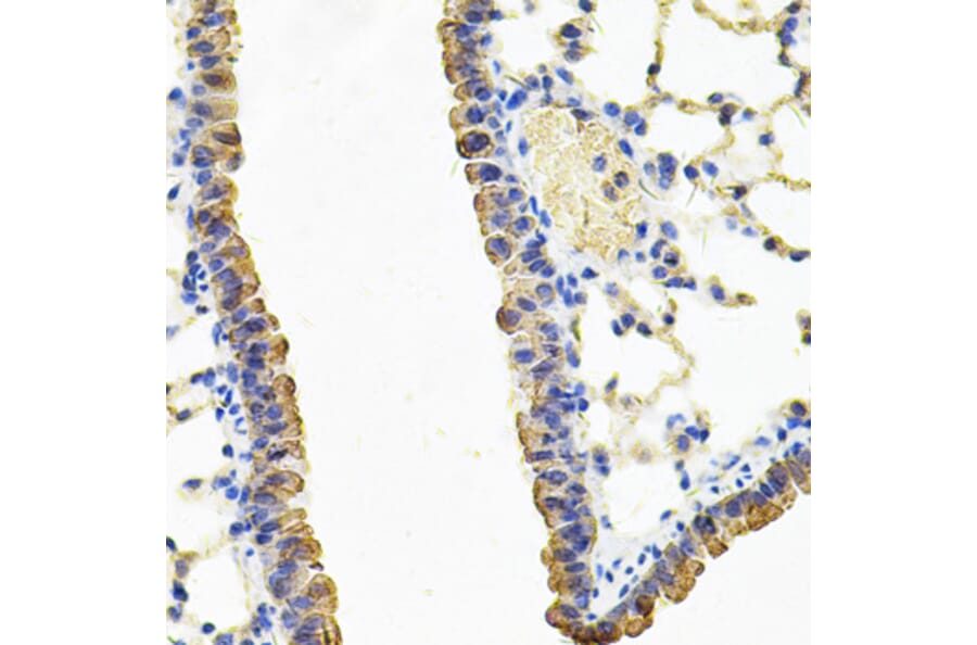 Immunohistochemistry - Anti-CARS Antibody (A13676) - Antibodies.com