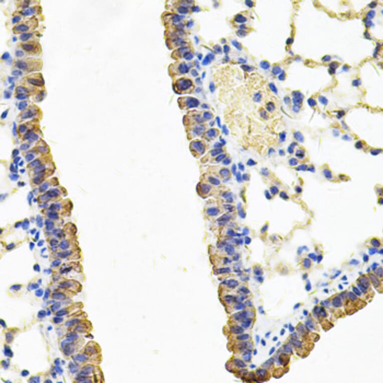 Immunohistochemistry - Anti-CARS Antibody (A13676) - Antibodies.com