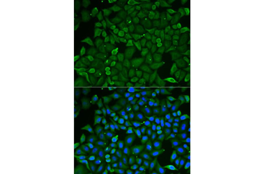 Immunofluorescence - Anti-CARS Antibody (A13676) - Antibodies.com