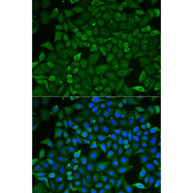 Immunofluorescence - Anti-CARS Antibody (A13676) - Antibodies.com
