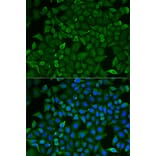 Immunofluorescence - Anti-CARS Antibody (A13676) - Antibodies.com