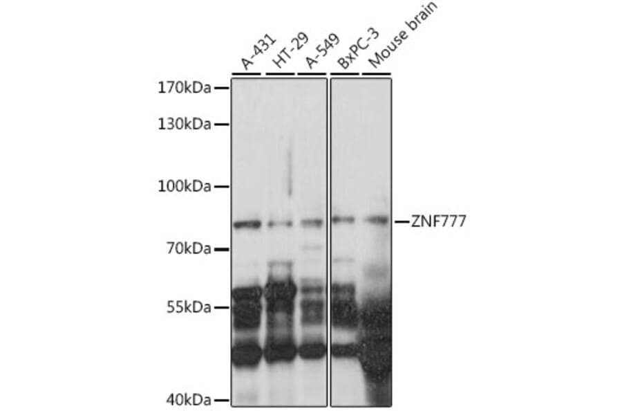 Western Blot - Anti-ZNF777 Antibody (A91355) - Antibodies.com