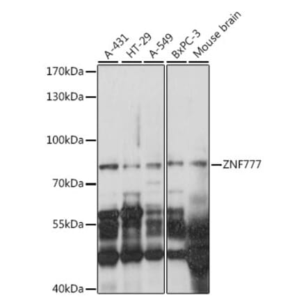 Western Blot - Anti-ZNF777 Antibody (A91355) - Antibodies.com