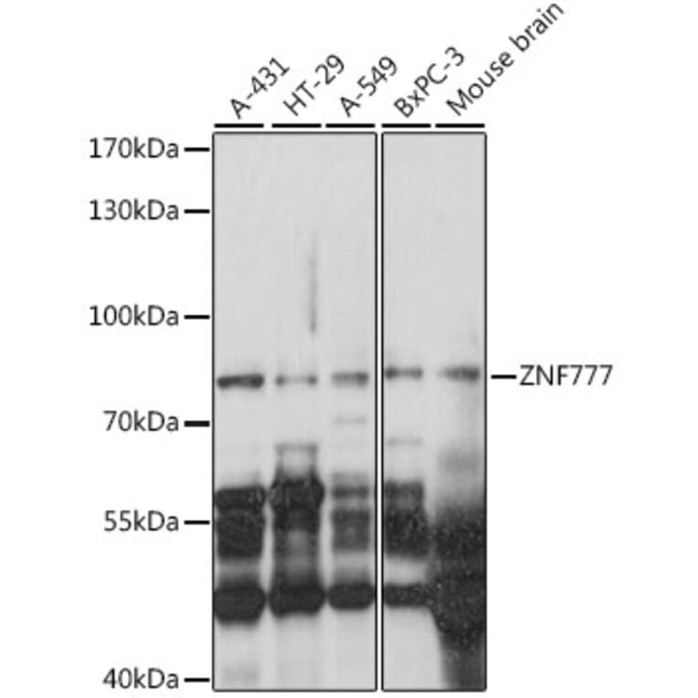 Western Blot - Anti-ZNF777 Antibody (A91355) - Antibodies.com